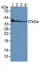 Polyclonal Antibody to Connective Tissue Growth Factor (CTGF)