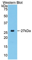 Polyclonal Antibody to Connective Tissue Growth Factor (CTGF)