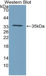 Polyclonal Antibody to Connective Tissue Growth Factor (CTGF)