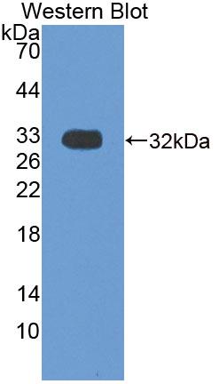 Polyclonal Antibody to Brain Derived Neurotrophic Factor (BDNF)