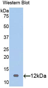 Polyclonal Antibody to S100 Calcium Binding Protein (S100)