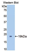 Polyclonal Antibody to Bone Morphogenetic Protein 2 (BMP2)