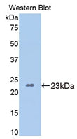 Polyclonal Antibody to Bone Morphogenetic Protein 4 (BMP4)