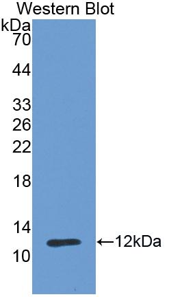 Polyclonal Antibody to E-cadherin