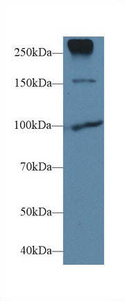 Polyclonal Antibody to E-cadherin