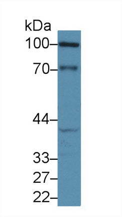 Polyclonal Antibody to E-cadherin