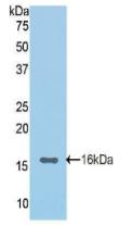 Polyclonal Antibody to E-cadherin