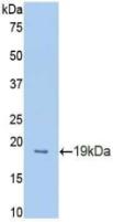 Polyclonal Antibody to Endothelial protein C receptor (EPCR)