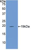 Polyclonal Antibody to Endothelial protein C receptor (EPCR)