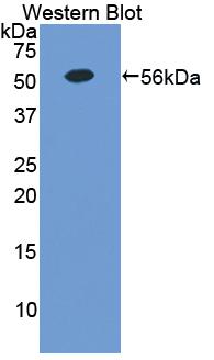 Polyclonal Antibody to Erythropoietin Receptor (EPOR)