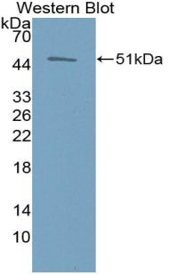 Polyclonal Antibody to Erythropoietin (EPO)