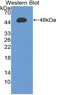 Polyclonal Antibody to Erythropoietin (EPO)