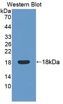 Polyclonal Antibody to Factor Related Apoptosis (FAS)