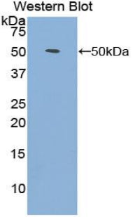 Polyclonal Antibody to Fibroblast Growth Factor 1, Acidic (FGF1)