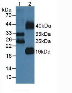 Polyclonal Antibody to FMS Like Tyrosine Kinase 3 Ligand (Flt3L)