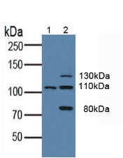 Polyclonal Antibody to FMS Like Tyrosine Kinase 3 (Flt3)
