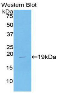 Polyclonal Antibody to Colony Stimulating Factor 3, Granulocyte (GCSF)