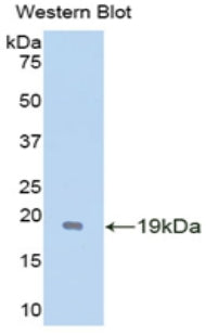 Polyclonal Antibody to Glial Cell Line Derived Neurotrophic Factor (GDNF)