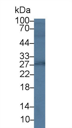 Polyclonal Antibody to Growth Hormone (GH)