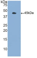 Polyclonal Antibody to Colony Stimulating Factor 2, Granulocyte Macrophage (GM-CSF)