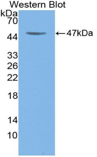 Polyclonal Antibody to Colony Stimulating Factor 2, Granulocyte Macrophage (GM-CSF)