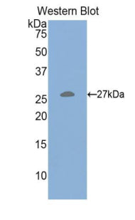 Polyclonal Antibody to Hepatocyte Growth Factor (HGF)