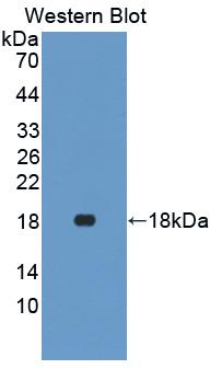 Polyclonal Antibody to Interferon Gamma (IFNg)