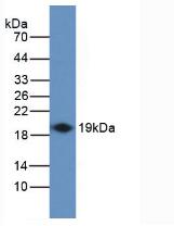 Polyclonal Antibody to Interferon Gamma (IFNg)