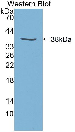 Polyclonal Antibody to Insulin Like Growth Factor 1 (IGF1)