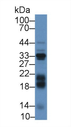 Polyclonal Antibody to Insulin Like Growth Factor Binding Protein 3 (IGFBP3)