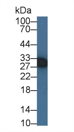 Polyclonal Antibody to Insulin Like Growth Factor Binding Protein 3 (IGFBP3)