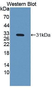 Polyclonal Antibody to Insulin Like Growth Factor Binding Protein 4 (IGFBP4)