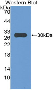 Polyclonal Antibody to Insulin Like Growth Factor Binding Protein 4 (IGFBP4)