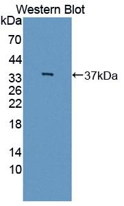 Polyclonal Antibody to Interleukin 12B (IL12B)