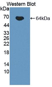 Polyclonal Antibody to Interleukin 12B (IL12B)