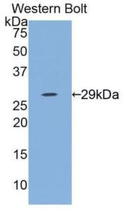 Polyclonal Antibody to Interleukin 12A (IL12A)