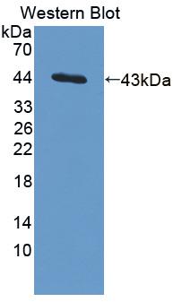 Polyclonal Antibody to Interleukin 13 (IL13)