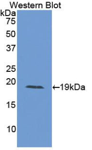 Polyclonal Antibody to Interleukin 15 (IL15)