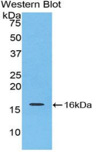 Polyclonal Antibody to Interleukin 16 (IL16)