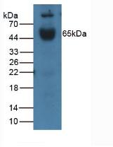 Polyclonal Antibody to Interleukin 1 Receptor Type I (IL1R1)