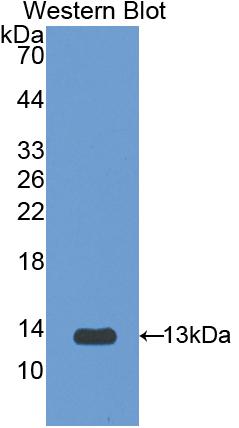 Polyclonal Antibody to Interleukin 1 Receptor Type I (IL1R1)