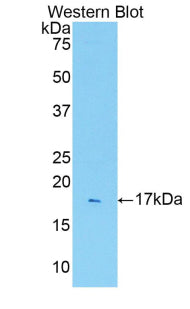 Polyclonal Antibody to Interleukin 1 Receptor Type I (IL1R1)