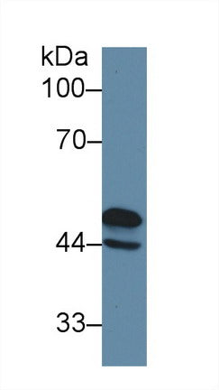 Polyclonal Antibody to Glial Fibrillary Acidic Protein (GFAP)