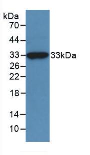 Polyclonal Antibody to Meningioma Expressed Antigen 5 (MGEA5)