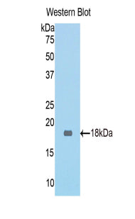 Polyclonal Antibody to Meningioma Expressed Antigen 5 (MGEA5)