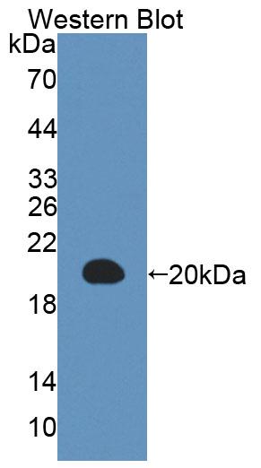 Polyclonal Antibody to Interleukin 3 (IL3)