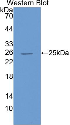 Polyclonal Antibody to Interleukin 6 (IL6)