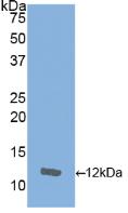 Polyclonal Antibody to Interleukin 8 (IL8)