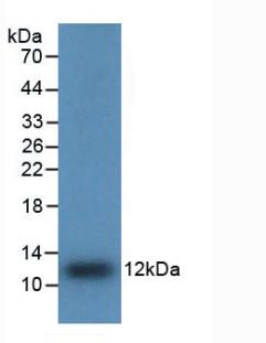 Polyclonal Antibody to Interleukin 8 (IL8)