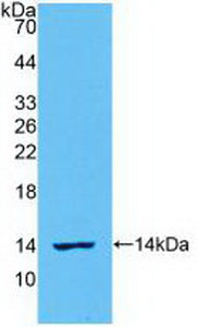 Polyclonal Antibody to Interleukin 8 (IL8)